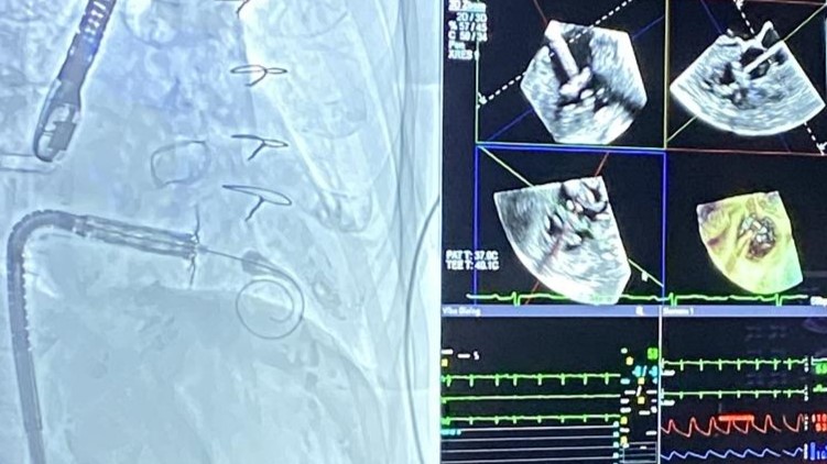 Cardio Scan