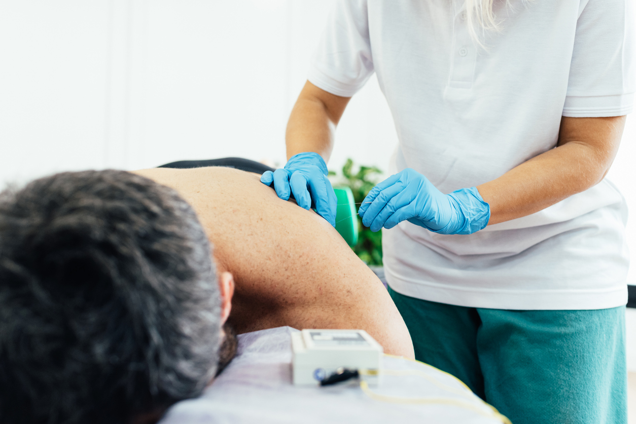 HSSatNCH Dry Needling Stock